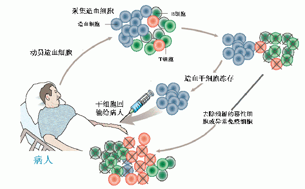 干细胞移植过程