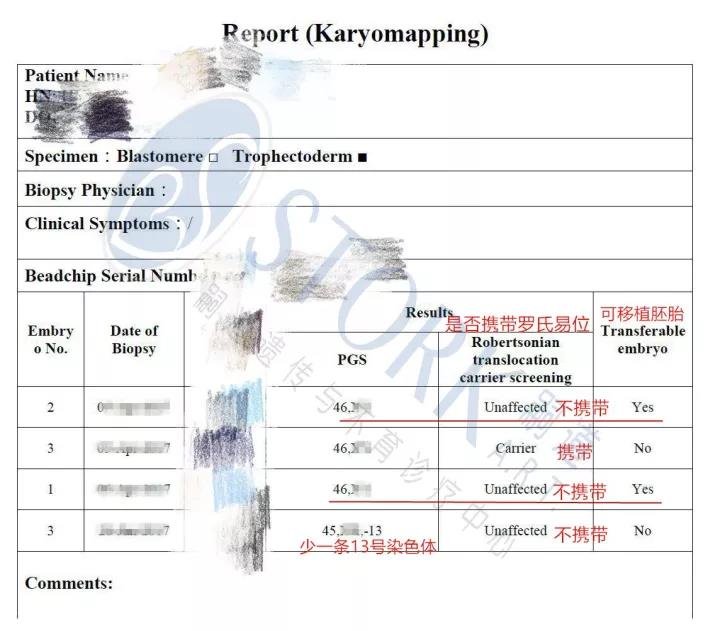 W女士的karyomapping核型定位芯片技术报告