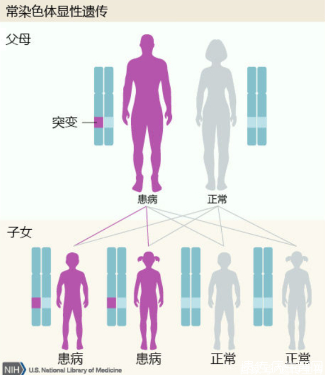 常染色体显性遗传